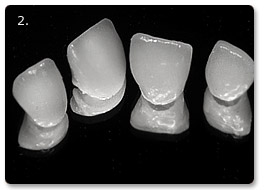 Beispiel Implantat